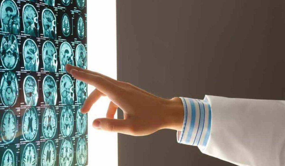 Врачи в России бьют тревогу из-за смертельной инфекции